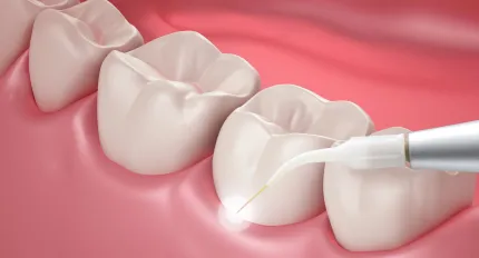 Crown Lengthening